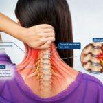 what is cervicalgia - causes, symptoms and treatment